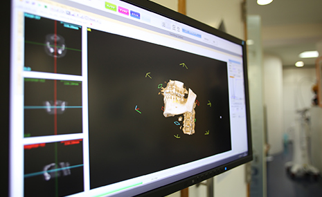 歯科用CTによる正確な診断・治療を実現